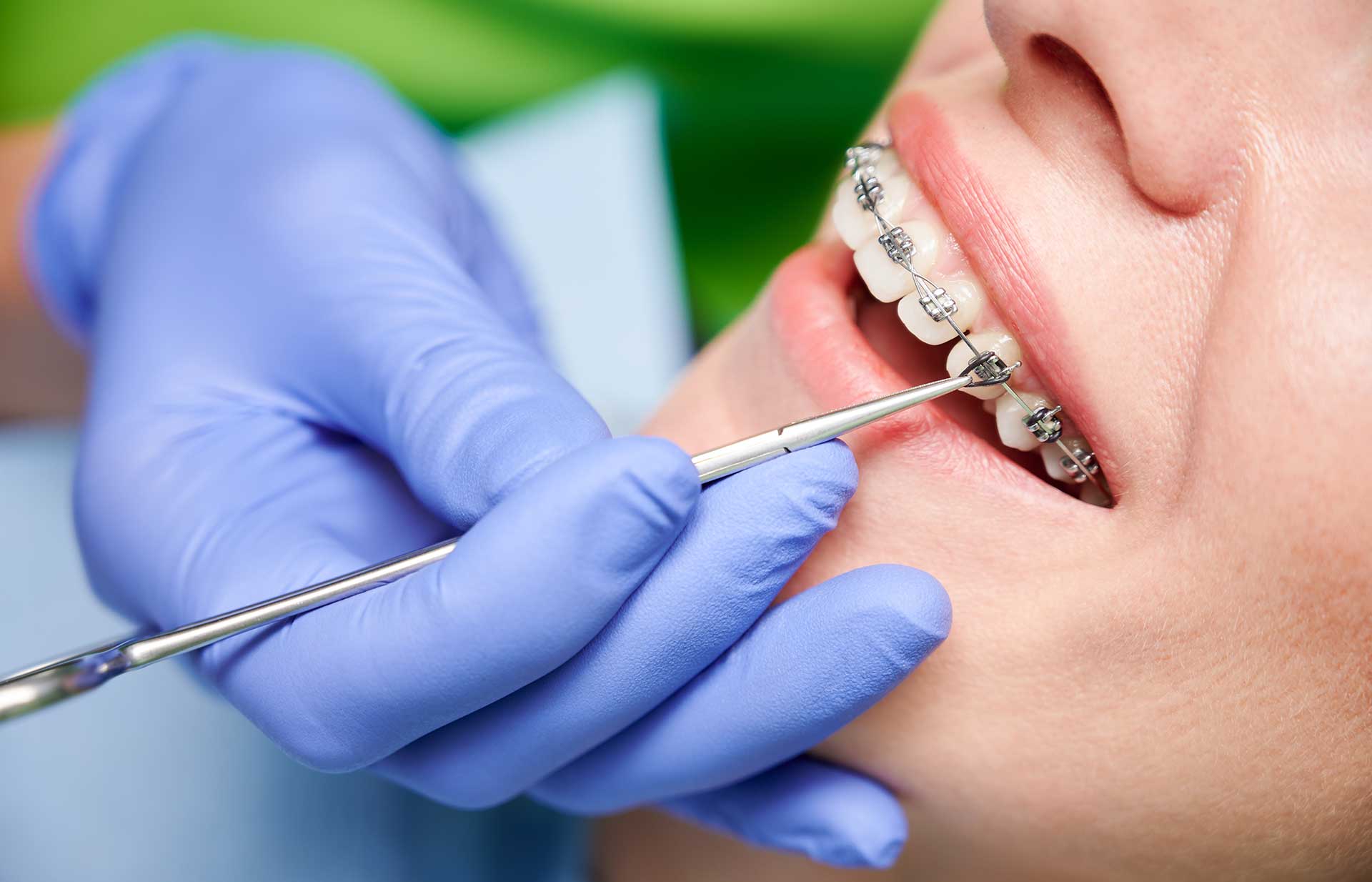 orthodontist in garvey 